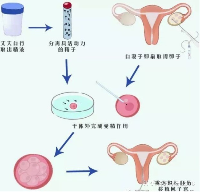 做供卵试管生子怀上双胞胎的几率有多大？了解更多