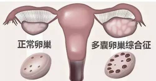 太原山大一院和省妇幼保健院借卵做试管医院哪个好？