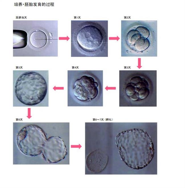 供卵试管超短方案流程是怎样适用于哪些人群