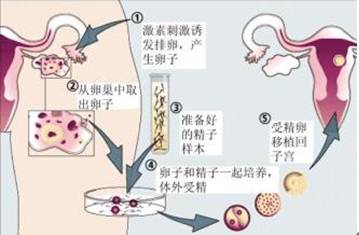 试管胚胎怎么分辨男女