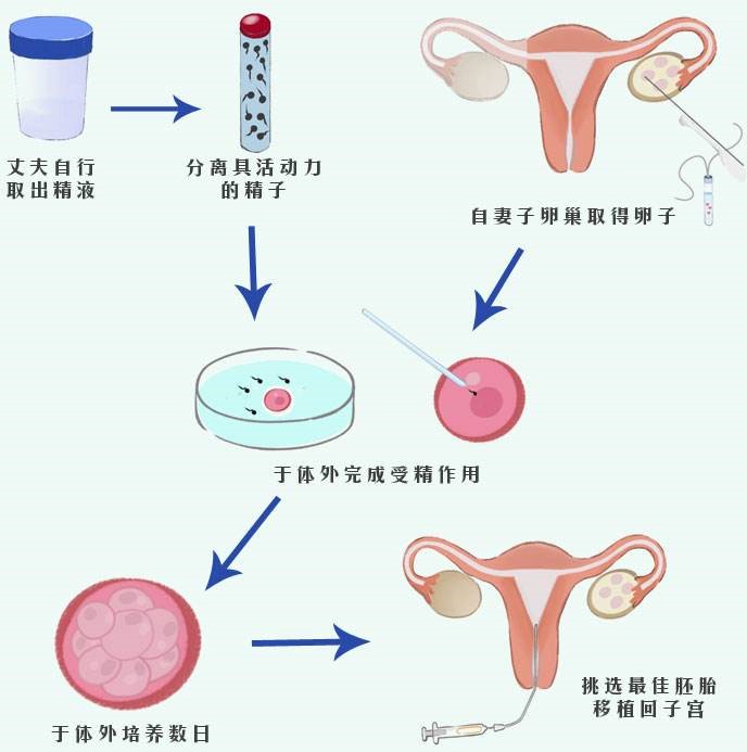 吉林长春医大一试管婴儿哪个医生比较好