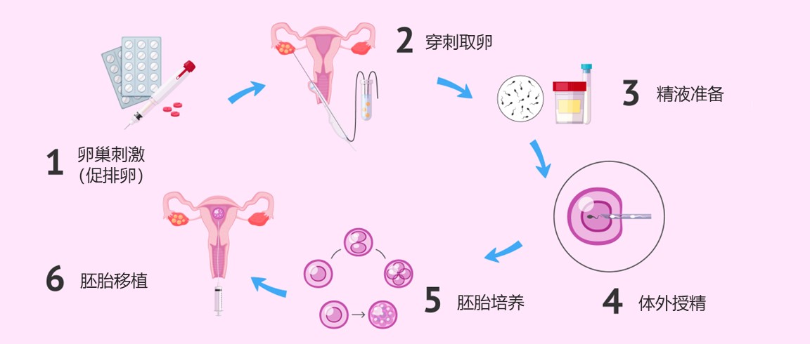 每个月都可以促排取卵吗