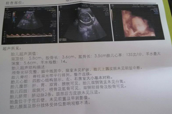 「代怀包性别建档还需准生证吗」吉林合法供卵机构一次成功容易吗