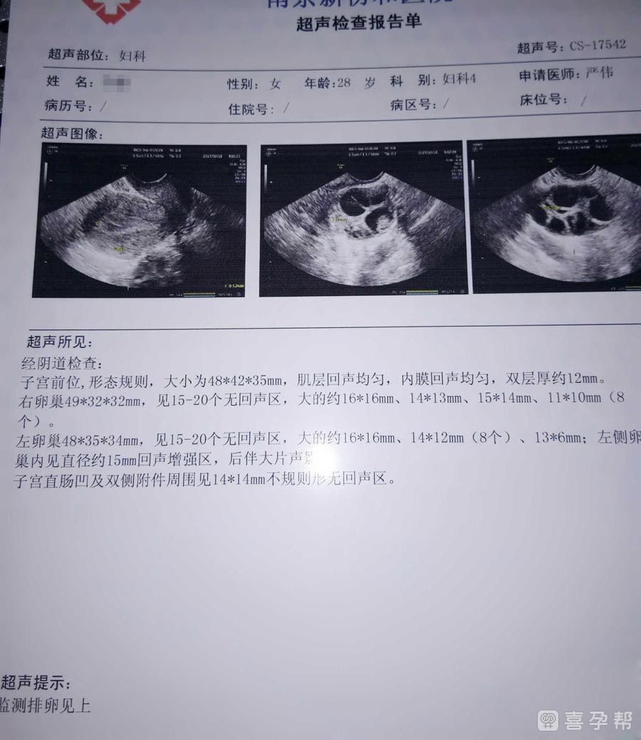 吉林长春助孕详细流程分享（前中后期全套）